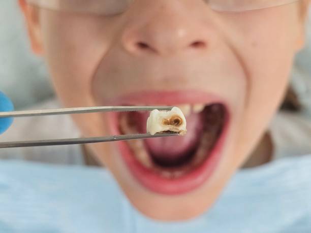 Best Weekend Emergency Dentist in Lincoln, AR